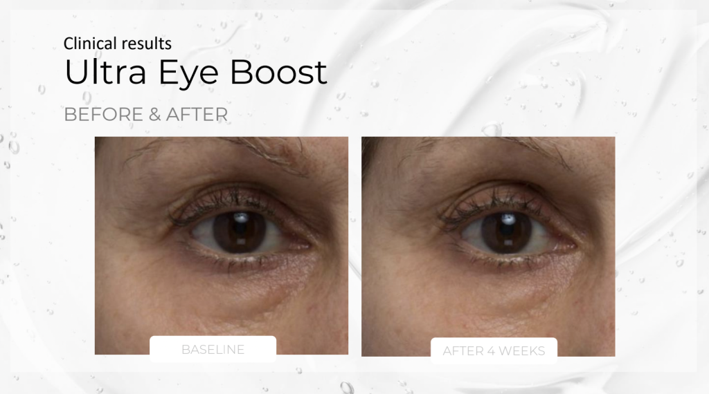 Ultra Eye Boost – product details, medical-grade skincare by Zahav Medspa